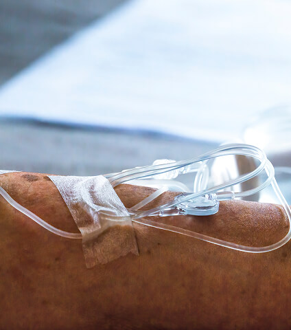 Suivi postopératoire 